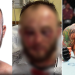 Polonês mostra nas redes sociais como ficou ‘amassado’ ao perder no UFC para amazonense; veja