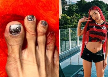 Ruivinha de Marte exibe pés judiados e pergunta se tem jeito