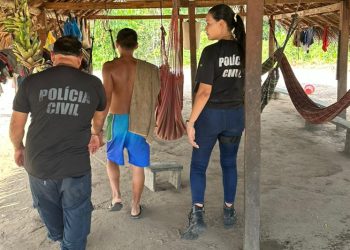 Tio deixa bebê de 9 meses com crânio exposto e rosto desfigurado no interior do AM