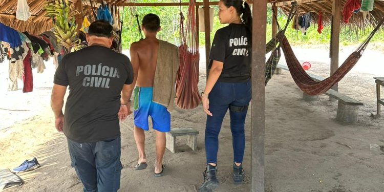 Tio deixa bebê de 9 meses com crânio exposto e rosto desfigurado no interior do AM