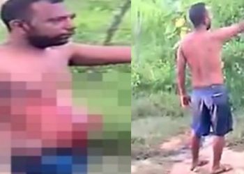 Vídeo: esfaqueado anda com pedaço do intestino para fora e acusa blindada de agressão  