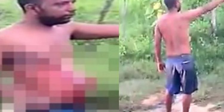 Vídeo: esfaqueado anda com pedaço do intestino para fora e acusa blindada de agressão  