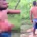 Vídeo: esfaqueado anda com pedaço do intestino para fora e acusa blindada de agressão  