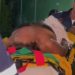 Mulher sai de motel na maca do Samu após ser estrangulada e roubada pelo 'companheiro' em Manaus