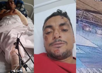 Câmera registra motorista fugindo após atropelar homem na Avenida Torquato Tapajós; vítima está em estado grave