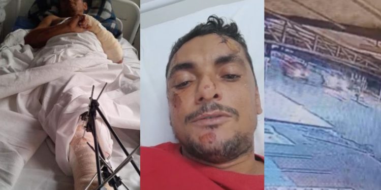 Câmera registra motorista fugindo após atropelar homem na Avenida Torquato Tapajós; vítima está em estado grave