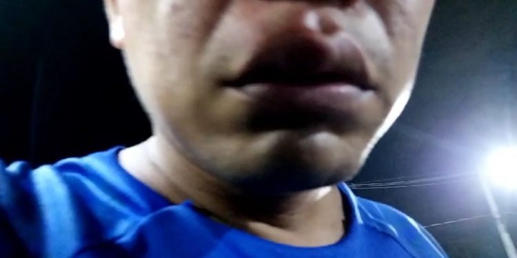 Outro motorista é atacado com pedradas enquanto dirigia no Tarumã; bateu o carro