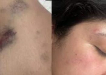 Em Manaus, cantora denuncia o namorado lutador por tentativa de feminicídio