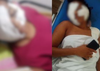 Mulher está internada em Manaus após levar 17 facadas do ex-marido
