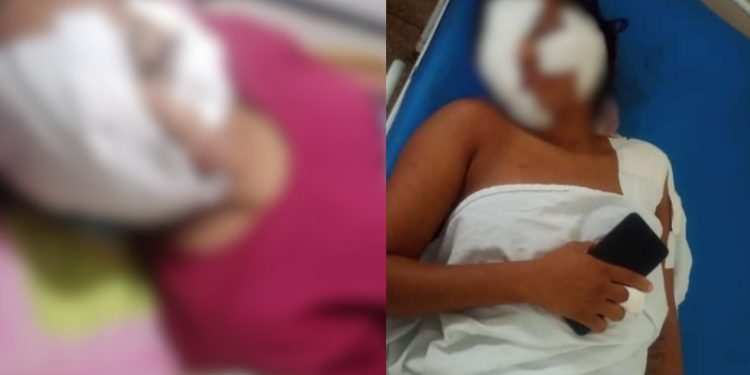 Mulher está internada em Manaus após levar 17 facadas do ex-marido