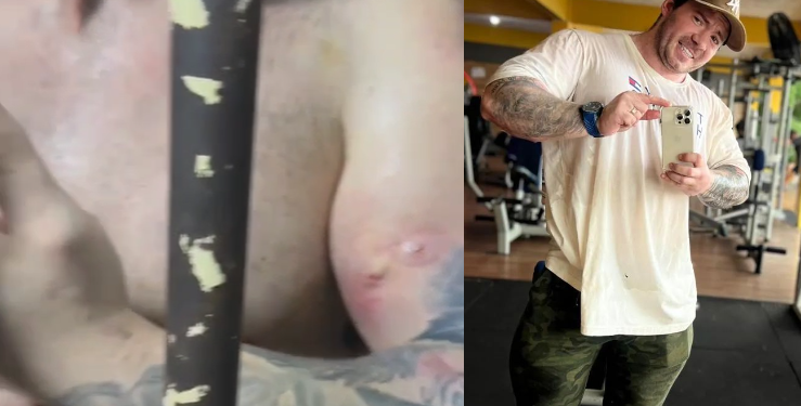 Vídeo mostra ‘buraqueira’ nas pernas de Hatus e braços ‘picados’ por seringas de droga; veja
