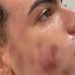 Homem que morreu tentando tratar pele do rosto arregalou os olhos na hora da morte