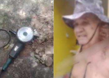 Alerta: Trabalhador com serra elétrica sofre acidente e deixa o ‘bucho’ pra fora; veja