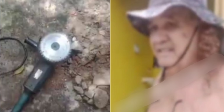 Alerta: Trabalhador com serra elétrica sofre acidente e deixa o ‘bucho’ pra fora; veja