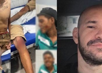 Delegado do interior do AM é suspeito de atropelar jovem de propósito com a viatura