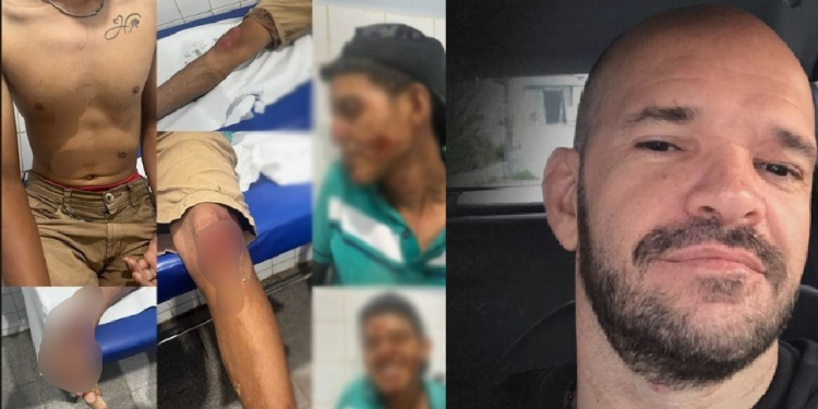 Delegado do interior do AM é suspeito de atropelar jovem de propósito com a viatura