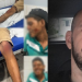 Delegado do interior do AM é suspeito de atropelar jovem de propósito com a viatura
