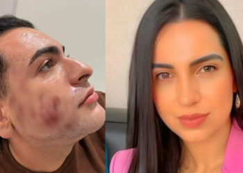 Jovem paga R$ 4,5 mil por ‘peeling de fenol’ e acaba morto em clínica famosinha do Insta