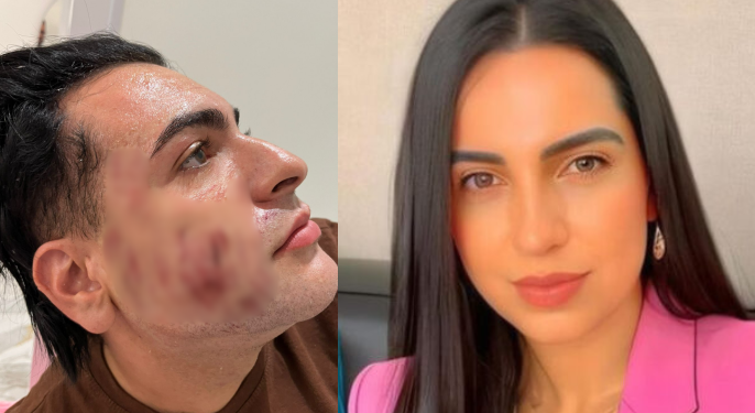 Jovem paga R$ 4,5 mil por ‘peeling de fenol’ e acaba morto em clínica famosinha do Insta