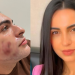 Jovem paga R$ 4,5 mil por ‘peeling de fenol’ e acaba morto em clínica famosinha do Insta