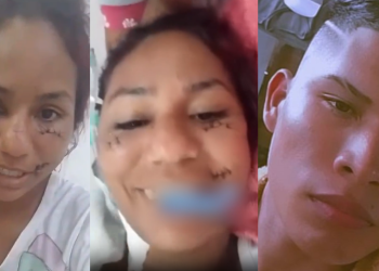 Vídeo: ‘Vai ficar assim pro resto da vida’, diz mulher mostrando o rosto após levar 17 facadas do ex no AM