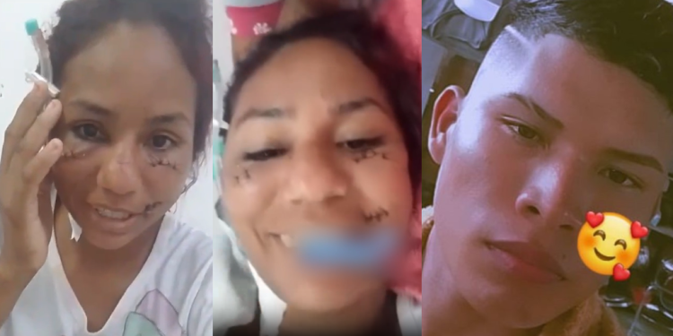 Vídeo: ‘Vai ficar assim pro resto da vida’, diz mulher mostrando o rosto após levar 17 facadas do ex no AM