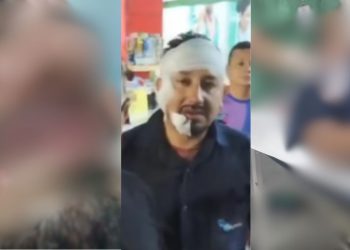 VÍDEO: Motorista esfaqueado três vezes no rosto mostra as feridas após sair da UPA em Manaus