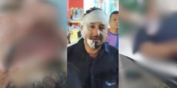 VÍDEO: Motorista esfaqueado três vezes no rosto mostra as feridas após sair da UPA em Manaus