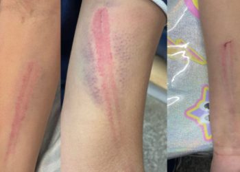 Polícia prende mãe a padrasto que agrediram adolescente de 15 anos no Jorge Teixera