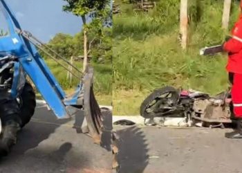 Vítimas de acidente em Parintins tiveram várias fraturas após colisão com trator na estrada