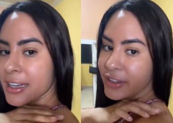 Vídeo: Isabelle exibe hematomas provocados por indumentária do Garantido: ‘costa cheia de marcas’