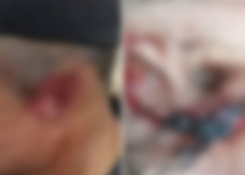 Orelhas de casal são arrancadas e jogadas para os bichos comerem no interior do Amazonas