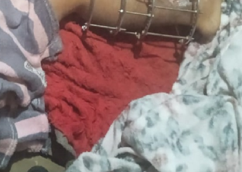 Veja: Com pinos na perna após acidente de moto, homem é morto ao ter a casa invadida em Manacapuru