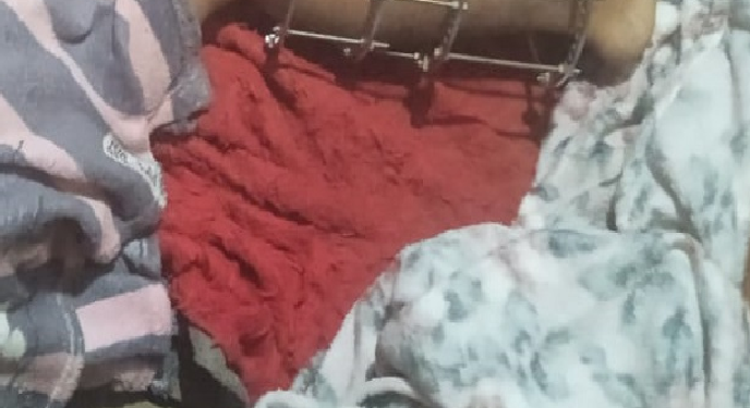 Veja: Com pinos na perna após acidente de moto, homem é morto ao ter a casa invadida em Manacapuru