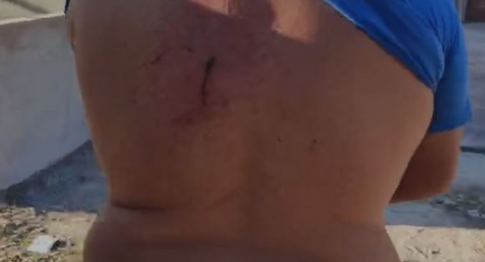 Vídeo: Homem leva tiro nas costas e apanha mesmo entregando carro a assaltantes em Manaus