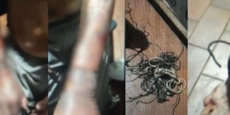 Delegado captura mulher que deixou idoso de 84 anos ferido durante roubo Itacoatiara