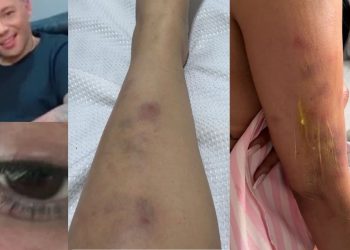 Polícia investiga empresário de Manaus que roubou a ex-esposa e a deixou 'toda roxa'