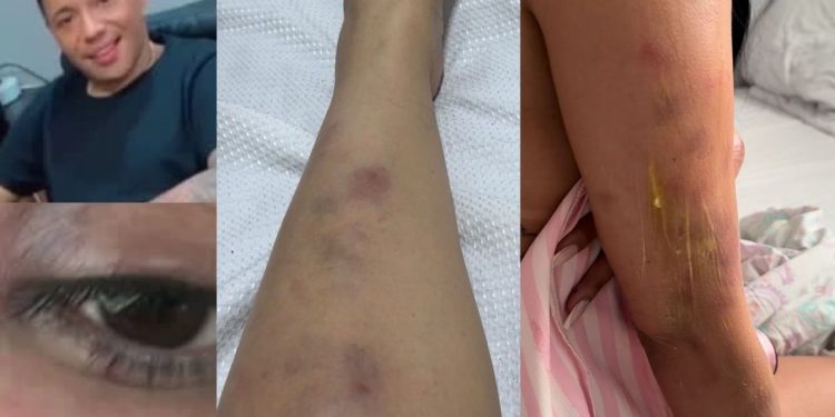 Polícia investiga empresário de Manaus que roubou a ex-esposa e a deixou 'toda roxa'
