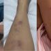 Polícia investiga empresário de Manaus que roubou a ex-esposa e a deixou 'toda roxa'