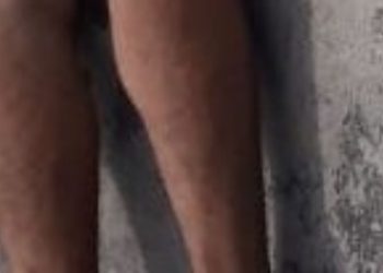 Homem morre na zona norte de Manaus após ser alvejado na cabeça por criminosos