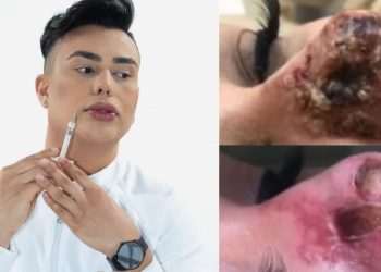 “Dei todo acolhimento”, diz dentista após ser ameaçado por paciente que ficou com o nariz ‘podre’ em Manaus