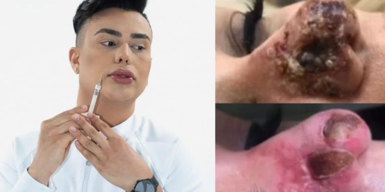 “Dei todo acolhimento”, diz dentista após ser ameaçado por paciente que ficou com o nariz ‘podre’ em Manaus