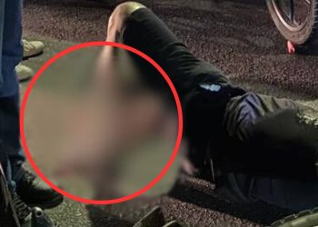 Fratura exposta: imagem mostra como ficou a perna de motociclista atingido por carro em Manaus