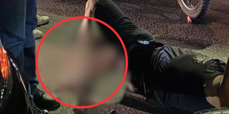 Fratura exposta: imagem mostra como ficou a perna de motociclista atingido por carro em Manaus