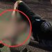 Fratura exposta: imagem mostra como ficou a perna de motociclista atingido por carro em Manaus