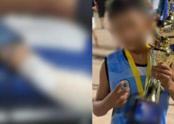 Garoto de 10 anos que teve os dedos d3c3pados supostamente seria envolvido no crime em Manaus