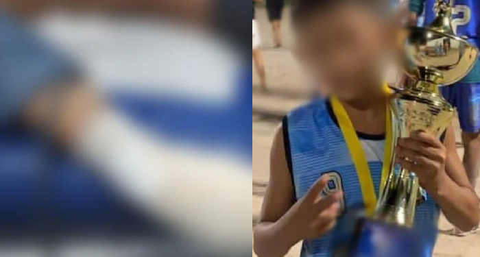 Garoto de 10 anos que teve os dedos d3c3pados supostamente seria envolvido no crime em Manaus