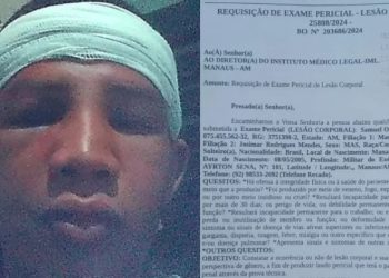 Militar do Exército diz ter apanhado tanto que perdeu a memória em Manaus: ‘apanhou na cabeça’