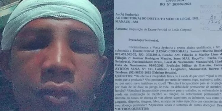 Militar do Exército diz ter apanhado tanto que perdeu a memória em Manaus: ‘apanhou na cabeça’