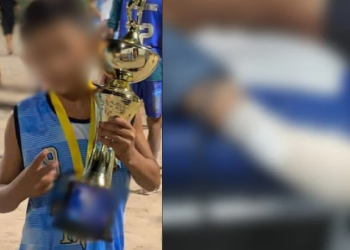 Revoltante: Em Manaus, traficantes ‘toram’ ded0s de garoto de 10 anos que vendeu cadeiras da escola